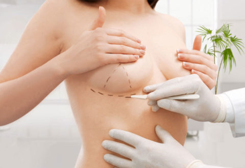 Chirurgia w raku piersi